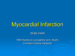 Myocardial Infacrction and ischeamia