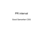 PR interval