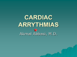 EKG Criteria