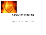 Cardiac Monitoring