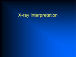 X-Ray Interpretation