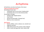 Arrhythmia 315