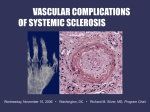 SSc: A Vascular Disease