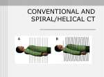 SINGLE SLICE SPIRAL/HELICAL CT