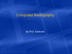 photostimulable luminescence (PSL).