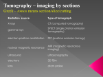 Electron Tomography