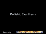 Pediatric Exanthems