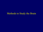 Methods to Study the Brain - Grand Haven Area Public Schools