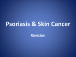 Psoriasis & Skin Cancer