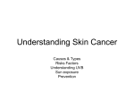 Understanding Skin Cancer