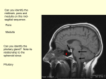 Cavernous Sinus Anatomy