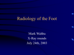 Radiology of the Foot