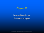 Normal Anatomy