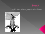 Neck