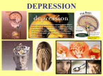 Depression