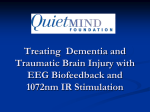 The Efficacy of Neurofeedback for Mild Traumatic Brain Injury