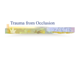 Trauma from Occlusion