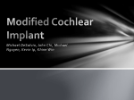 Modified Cochlear Implant