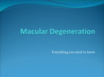 Macular Degeneration - Norman Salmoni Opticians