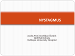 nystagmus 2013