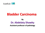 Bladder Cancer