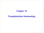 Transplantation - Shandong University