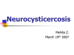 PERIPHERAL NEUROPATHY