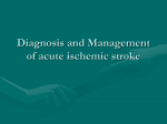 Ischemic_stroke