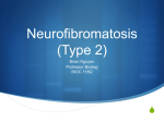 Brian Nguyen - Neurofibromatosis (Type 2)