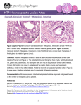 Stomach, Glandular Stomach – Metaplasia, Intestinal