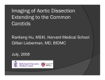 Imaging of Aortic Dissection Extending to the Common Carotids