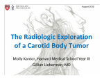 The Radiologic Exploration of a Carotid Body Tumor