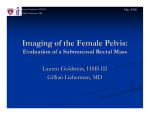 Imaging of the Female Pelvis: Evaluation of a Submucosal Rectal Mass