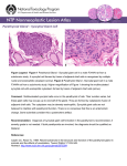 Parathyroid Gland – Syncytial Giant Cell