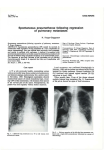 Spontaneous  pneumothorax  following  regression N.  Kryger-Baggesen