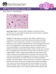 – Chromatolysis Brain, Neuron