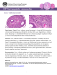 Ovary – Infiltration Cellular