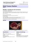 Solid Tumour Section Bladder: transitional cell carcinoma Atlas of Genetics and Cytogenetics