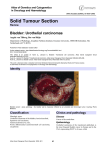 Solid Tumour Section Bladder: Urothelial carcinomas Atlas of Genetics and Cytogenetics