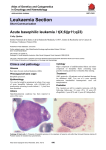 Leukaemia Section Acute basophilic leukemia / t(X;6)(p11;q23)  Atlas of Genetics and Cytogenetics