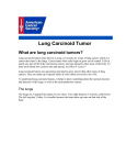 Lung Carcinoid Tumor What are lung carcinoid tumors?