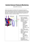 Central Venous Pressure Monitoring Normal CVP is 2