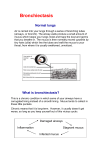 Bronchiectasis