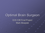 Optimal Brain Surgeon