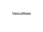 Vasculitises`