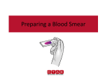 Preparing A Blood Smear PowerPoint
