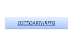 OSTEOARTHRITIS