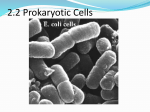 Electron micrographs of E. coli. Reproduction of prokaryotic cells by