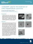 LC BeadM1® used for the treatment of a 4cm