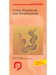 Colon Diverticula and Diverticulosis